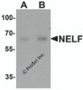 Western blot analysis of NELF in Hela cell lysate with NELF antibody at (A) 1 and (B) 2 &#956;g/mL.