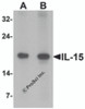 Western blot analysis of IL-15 in rat spleen tissue lysate with IL-15 antibody at (A) 1 and (B) 2 &#956;g/mL