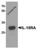 Western blot analysis of IL-15RA in rat small intestine tissue lysate with IL-15RA antibody at 1 &#956;g/mL.