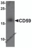 Western blot analysis of CD59 in mouse spleen tissue lysate with CD59 antibody at 1 &#956;g/mL