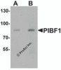Western blot analysis of PIBF1 in human placenta tissue lysate with PIBF1 antibody at (A) 1 and (B) 2 &#956;g/mL
