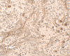 Immunohistochemistry of PBIF in human spleen tissue with PBIF antibody at 5 ug/ml.