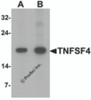 Western blot analysis of TNFSF4 in rat spleen tissue lysate with TNFSF4 antibody at (A) 0.5 and (B) 1 &#956;g/mL