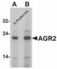 Western blot analysis of AGR2 in Hela cell lysate with AGR2 antibody at (A) 1 and (B) 2 &#956;g/mL