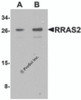 Western blot analysis of RRAS2 in Jurkat cell lysate with RRAS2 antibody at (A) 1 and (B) 2 &#956;g/mL