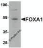Western blot analysis of FOXA1 in 293 cell lysate with FOXA1 antibody at 1 &#956;g/mL