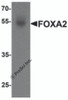 Western blot analysis of FOXA2 in human bladder tissue lysate with FOXA2 antibody at 1 &#956;g/mL.