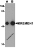 Western blot analysis of KREMEN1 in rat small intestine tissue lysate with KREMEN1 antibody at (A) 0.125 and (B) 0.25 &#956;g/mL