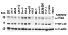 Figure 1 Independent Antibody Validation (IAV) via Protein Expression Profile in Human, Mouse and Rat Cell Lines
Loading: 15 &#956;g of lysates per lane.
Antibodies: KREMEN2, 7263 (2 &#956;g/mL) , KREMEN2, 64-235 (1 &#956;g/mL) and beta-actin, 3779 (2 &#956;g/mL) , 1h incubation at RT in 5% NFDM/TBST.
Secondary: Goat anti-rabbit IgG HRP conjugate at 1:10000 dilution.