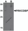 Western blot analysis of PRKCDBP in A20 cell lysate with PRKCDBP antibody at 1 &#956;g/mL in (A) the absence and (B) the presence of blocking peptide.