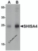 Western blot analysis of SHISA4 in human brain tissue lysate with SHISA4 antibody at (A) 1 and (B) 2 &#956;g/mL.