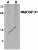 Western blot analysis of MOSPD1 in human brain tissue lysate with MOSPD1 antibody at 1 &#956;g/mL in (A) the absence and (B) the presence of blocking peptide.