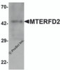 Western blot analysis of MTERFD2 in human small intestine tissue lysate with MTERFD2 antibody at 1 μg/mL.