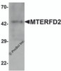 Western blot analysis of MTERFD2 in human small intestine tissue lysate with MTERFD2 antibody at 1 &#956;g/mL.