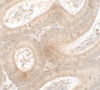 Immunohistochemistry of MTERFD3 in mouse testis tissue with MTERFD3 antibody at 2.5 ug/ml.