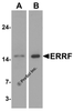 Western blot analysis of ERRF in (A) HeLa and (B) A-20 cell lysate with ERRF antibody at 1 &#956;g/mL.