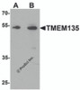 Western blot analysis of TMEM135 in rat liver tissue lysate with TMEM135 antibody at (A) 1 and (B) 2 &#956;g/mL.