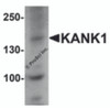 Western blot analysis of KANK1 in 3T3 cell lysate with KANK1 antibody at 1 &#956;g/mL.