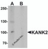Western blot analysis of KANK2 in mouse brain tissue lysate with KANK2 antibody at 1 &#956;g/mL in (A) the absence and (B) the presence of blocking peptide.