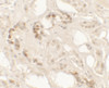 Immunohistochemistry of KANK2 in human kidney tissue with KANK2 antibody at 2.5 ug/ml.