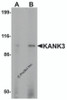 Western blot analysis of KANK3 in A431 cell lysate with KANK3 antibody at (A) 1 and (B) 2 &#956;g/mL.