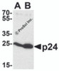 Western blot analysis of p24 using p24 antibody at 0.5 &#956;g/mL to detect (A) 2 ng and (B) 10 ng of recombinant HIV-1 p24.