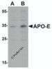 Western blot analysis of APO-E in human brain tissue lysate with APO-E antibody at (A) 0.5 and (B) 1 &#956;g/mL.