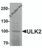 Western blot analysis of ULK2 in human brain tissue lysate with ULK2 antibody at 1 &#956;g/mL.