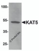 Western blot analysis of KAT5 in human brain tissue lysate with KAT5 antibody at 1 &#956;g/mL.