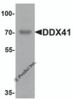 Western blot analysis of DDX41 in rat brain tissue lysate with DDX41 antibody at 1 &#956;g/mL.