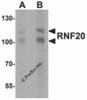 Western blot analysis of RNF20 in human liver tissue lysate with RNF20 antibody at (A) 1 and (B) 2 &#956;g/mL.