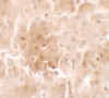 Immunohistochemistry of RNF20 in human liver tissue with RNF20 antibody at 2.5 ug/ml.