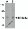Western blot analysis of TRIM33 in human liver tissue lysate with TRIM33 antibody at (A) 1 and (B) 2 &#956;g/mL.
