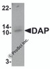 Western blot analysis of DAP in human small intestine tissue lysate with DAP antibody at 1 &#956;g/mL.