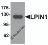 Western blot analysis of LPIN1 in K562 cell lysate with LPIN1 antibody at 1 &#956;g/mL.