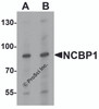 Western blot analysis of NCBP1 in HeLa cell lysate with NCBP1 antibody at (A) 1 and (B) 2 &#956;g/mL.