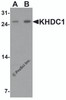 Western blot analysis of KHDC1 in rat liver tissue lysate with KHDC1 antibody at (A) 0.5 and (B) 1 &#956;g/mL.