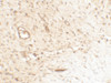 Immunohistochemistry of SPP1 in human bladder tissue with SPP1 antibody at 5 ug/mL.