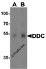 Western blot analysis of DDC in human lung tissue lysate with DDC antibody at (A) 0.5 and (B) 1 &#956;g/ml.