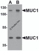 Western blot analysis of MUC1 in HeLa cell lysate with MUC1 antibody at (A) 1 and (B) 2 &#956;g/ml.