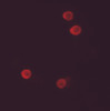 Immunofluorescence of FHIT in HeLa cells with FHIT antibody at 5 ug/mL.