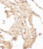 Immunohistochemistry of WFDC2 in human lung tissue with WFDC2 antibody at 2.5 ug/mL.