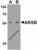 Western blot analysis of ARSB in mouse lung tissue lysate with ARSB antibody at (A) 1 and (B) 2 &#956;g/ml.