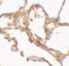 Immunohistochemistry of ARSB in human lung tissue with ARSB antibody at 2.5 ug/mL.