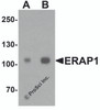 Western blot analysis of ERAP1 in SK-N-SH cell lysate with ERAP1 antibody at (A) 1 and (B) 2 &#956;g/ml.