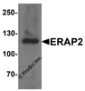Western blot analysis of ERAP2 in human ovary tissue lysate with ERAP2 antibody at 1 &#956;g/ml.