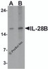 Western blot analysis of IL-28B in HeLa cell lysate with IL-28B antibody at (A) 1 and (B) 2 &#956;g/ml.