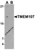 Western blot analysis of TMEM107 in THP-1 cell lysate with TMEM107 antibody at 1 &#956;g/ml in (A) the absence and (B) the presence of blocking peptide.