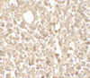 Immunohistochemistry of TMEM107 in human lymph node tissue with TMEM107 antibody at 5 ug/mL.