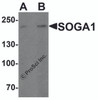Western blot analysis of SOGA1 in Hela cell lysate with SOGA1 antibody at (A) 1 and (B) 2 &#956;g/ml.